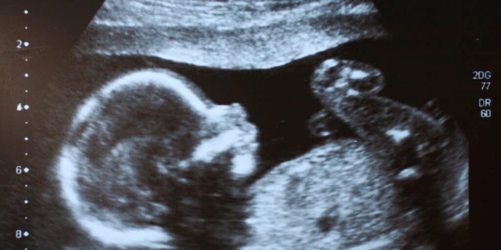 Entenda a importância da ultrassonografia durante a gestação