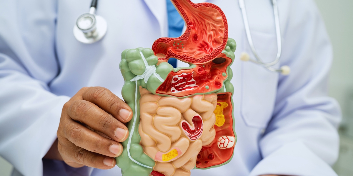 Desvendando a Saúde Digestiva: um Sistema Digestivo Saudável