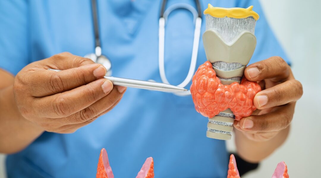 Compreendendo o Hipertireoidismo: Sintomas e Tratamentos