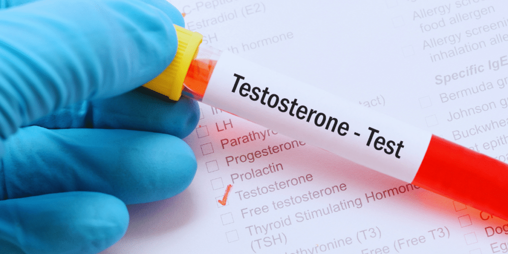 Sintomas das mudanças hormonais masculinas